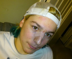 hockey scar